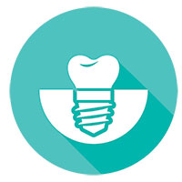 Dental Implants in Pembroke Pines